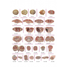 TAM BOY İNSAN KESİTLERİ (MONTAJSIZ)